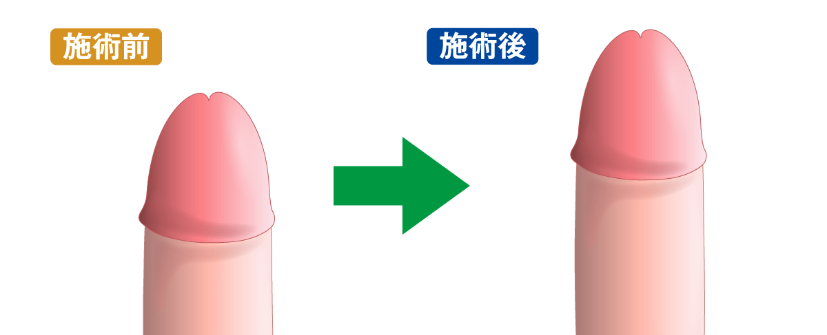 長くバランスのいい見た目に