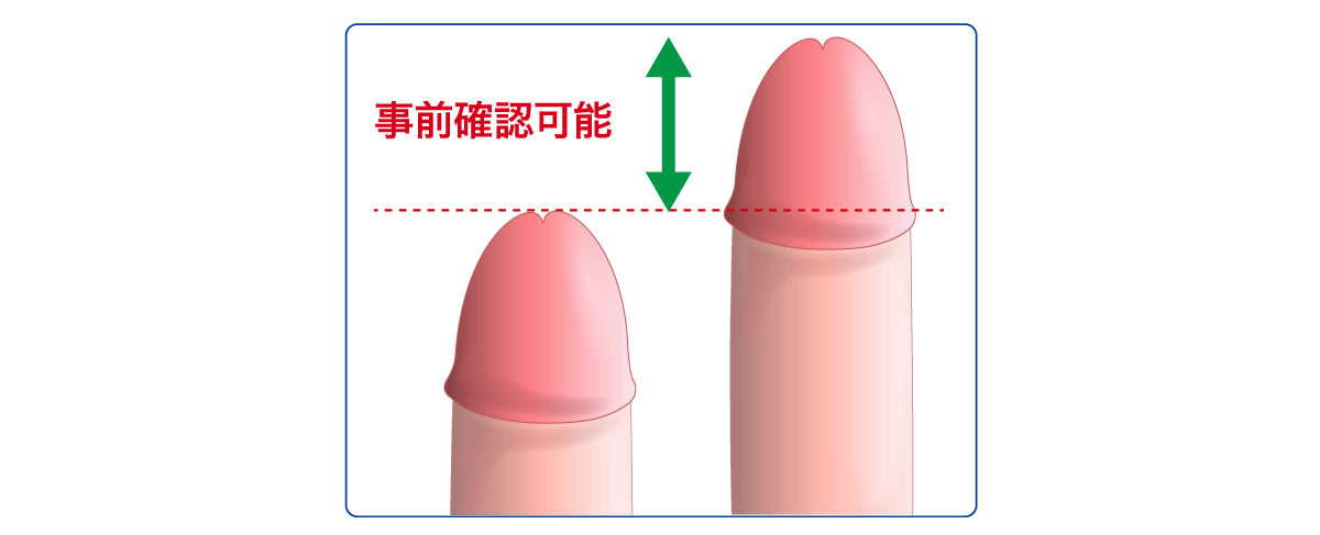 全体注入法