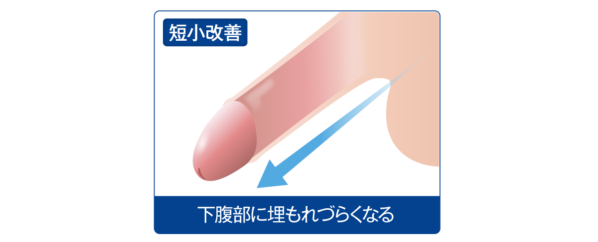 包茎・早漏の改善効果