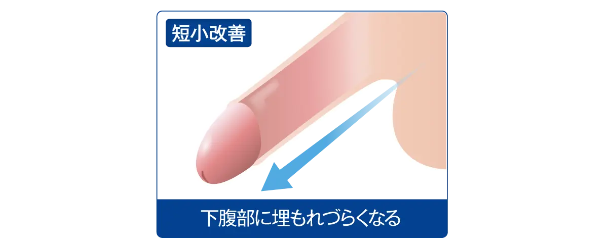 短小ペニスの改善にも効果的