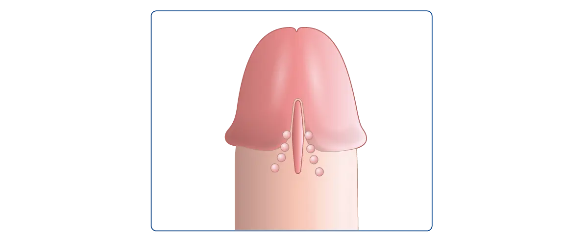 見た目が良くない脂肪のかたまり