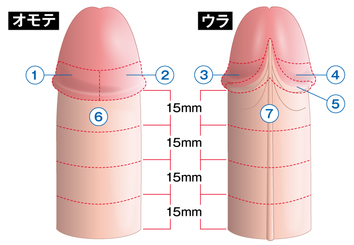 ペニスのブツブツ除去治療の費用