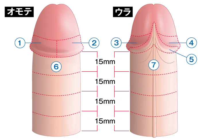 ペニスのブツブツ除去治療の費用