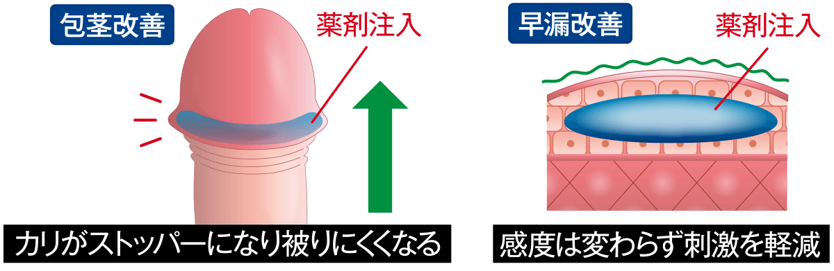 包茎・早漏の改善効果
