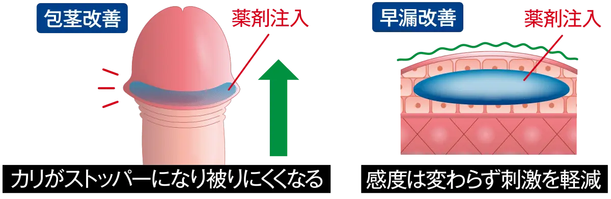 包茎・早漏の改善効果