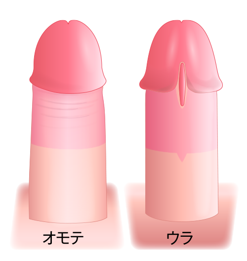 精密切除