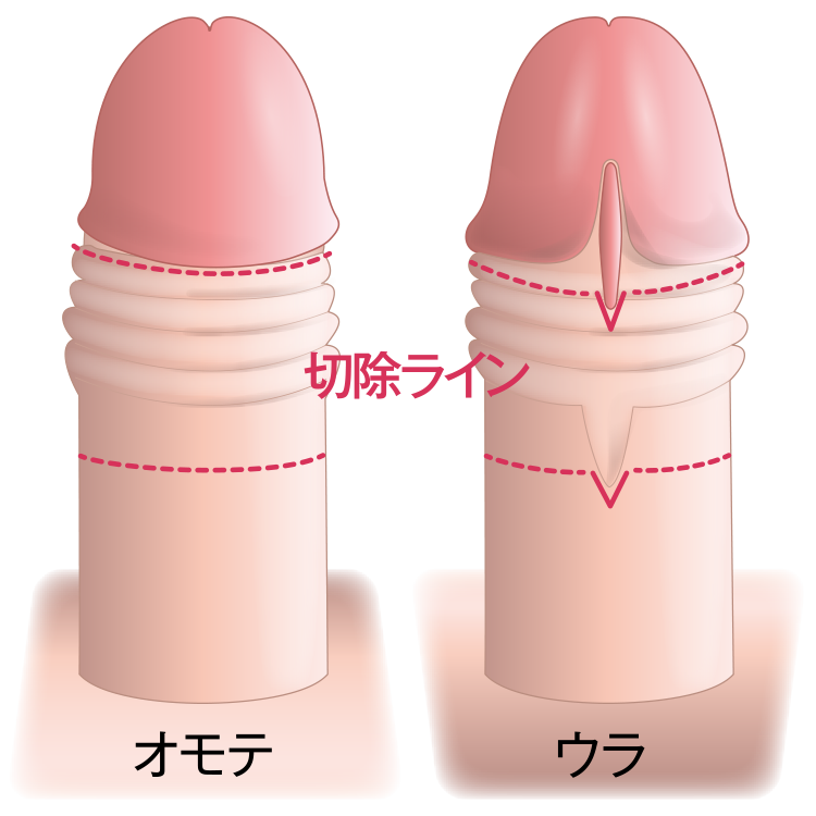 デザイン