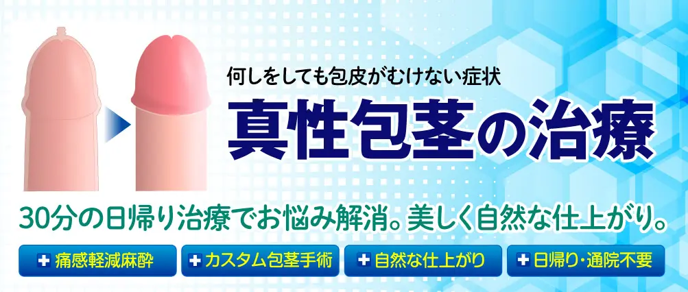 30分の日帰り治療・美しく自然な仕上がり！包茎手術・治療｜仮性：5万円～｜真性15万円～｜カントン：12万円～